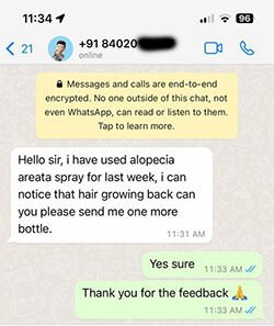 alopecia review (1)
