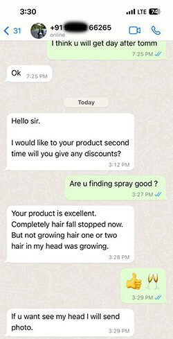 alopecia areata spray review