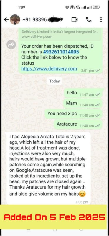 Alopecia Areata Review
